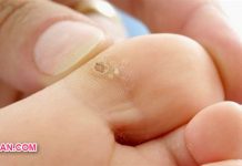 Penyakit Mata Ikan: Penyebab, Gejalanya dan Cara Mengobatinya Penyakit Mata Ikan Penyebab, Gejalanya dan Cara Mengobatinya