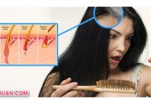 4 Pilihan Cara Mengurangi Rambut Rontok yang Tepat Cara Mengurangi Rambut Rontok