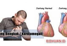 Pembengkakan Jantung: Penyebab, Gejala, Ciri Jantung Bengkak, Pencegahan dan Terapi Penyembuhan Pembengkakan Jantung - Penyebab Gejala Ciri Jantung Bengkak Pencegahan dan Terapi Penyembuhan
