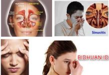 Penyakit Sinusitis: Gejala, Penyebab, Akibat, Bahaya dan Pengobatannya Penyakit Sinusitis - Gejala Penyebab Akibat Bahaya dan Pengobatannya