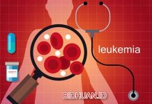 Penyebab Leukemia - Pengertian Jenis Penyakit dan Faktor Penyebab Utama