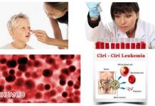 13 Gejala Leukimia (Kanker Darah) Yang Perlu Anda Waspadai 13 Gejala Leukimia (Kanker Darah) Yang Perlu Anda Waspadai