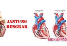 Pembengkakan Jantung: 6 Ciri dan 5 Penyebab Tandanya Serta 5 Resiko Jantung Bengkak Pembengkakan Jantung - 6 Ciri dan 5 Penyebab Tandanya Serta 5 Resiko Jantung Bengkak