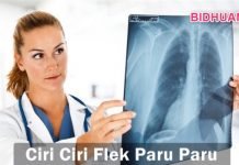 Flek Paru-Paru: Penyebab, Cara Mencegah dan Gejala Penyakit Paru Flek Paru-Paru - Penyebab Cara Mencegah dan Gejala Penyakit Paru