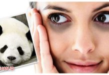 Mata Panda Hilang Seketika dengan 5 Cara Menghilangkan yang Jitu Mata Panda Hilang Seketika dengan 5 Cara Menghilangkan yang Jitu